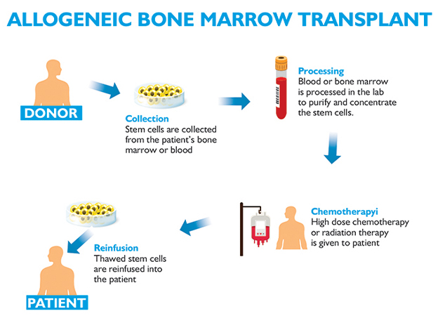 best bone marrow transplant in gurgaon